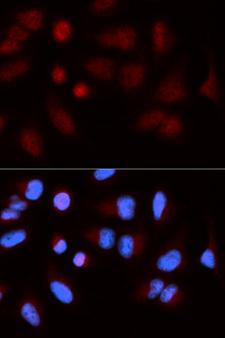 SH2B1 Antibody - Immunofluorescence analysis of U20S cell using SH2B1 antibody. Blue: DAPI for nuclear staining.