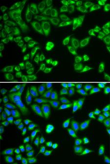SH2B1 Antibody - Immunofluorescence analysis of HeLa cells.