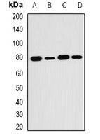 SH2B1 Antibody - Western blot analysis of SH2B1 expression in HT29 (A); MCF7 (B); mouse kidney (C); mouse brain (D) whole cell lysates.
