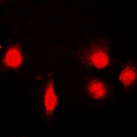 SH2B1 Antibody - Immunofluorescent analysis of SH2B1 staining in U2OS cells. Formalin-fixed cells were permeabilized with 0.1% Triton X-100 in TBS for 5-10 minutes and blocked with 3% BSA-PBS for 30 minutes at room temperature. Cells were probed with the primary antibody in 3% BSA-PBS and incubated overnight at 4 deg C in a humidified chamber. Cells were washed with PBST and incubated with a DyLight 594-conjugated secondary antibody (red) in PBS at room temperature in the dark.