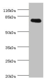 SH2B1 Antibody - Western blot All Lanes:SH2B1 antibody at 0.81ug/ml+293T whole cell lysate Secondary Goat polyclonal to rabbit at 1/10000 dilution Predicted band size: 80,71,73 kDa Observed band size: 79 kDa