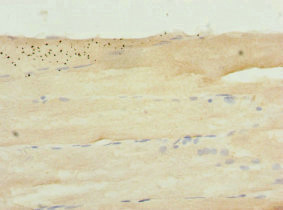 SH2B1 Antibody - Immunohistochemistry of paraffin-embedded human skeletal muscle tissue at dilution 1:100