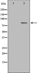SH2B1 Antibody - Western blot analysis of mouse brain lysate using SH2B1 antibody. The lane on the left is treated with the antigen-specific peptide.
