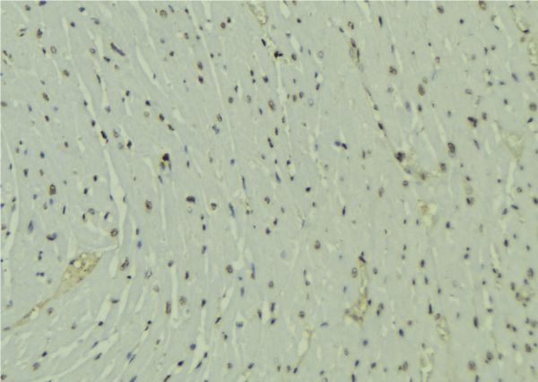 SH2B1 Antibody - 1:100 staining mouse muscle tissue by IHC-P. The sample was formaldehyde fixed and a heat mediated antigen retrieval step in citrate buffer was performed. The sample was then blocked and incubated with the antibody for 1.5 hours at 22°C. An HRP conjugated goat anti-rabbit antibody was used as the secondary.