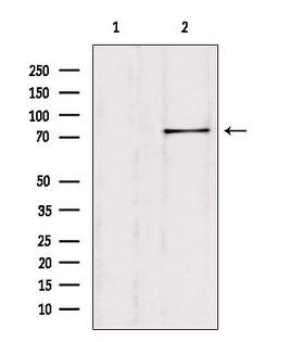 SH2B1 Antibody - Western blot analysis of extracts of HeLa cells using SH2B1 antibody. Lane 1 was treated with the blocking peptide.