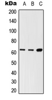SH2B3 / LNK Antibody - Western blot analysis of LNK expression in HEK293T (A); Raw264.7 (B); H9C2 (C) whole cell lysates.