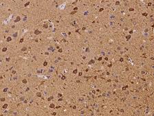 SH2B3 / LNK Antibody - Immunochemical staining of human SH2B3 in human brain with rabbit polyclonal antibody at 1:300 dilution, formalin-fixed paraffin embedded sections.