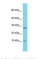 SH2D1A / SAP Antibody - Western blot of Human 293T. SH2D1A antibody dilution 1.0 ug/ml.  This image was taken for the unconjugated form of this product. Other forms have not been tested.