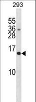 SH2D1A / SAP Antibody - SH2D1A Antibody western blot of 293 cell line lysates (35 ug/lane). The SH2D1A antibody detected the SH2D1A protein (arrow).
