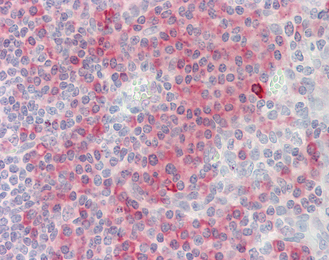 SH2D1A / SAP Antibody - Anti-SH2D1A / SAP antibody IHC staining of human tonsil. Immunohistochemistry of formalin-fixed, paraffin-embedded tissue after heat-induced antigen retrieval. Antibody concentration 10 ug/ml.  This image was taken for the unconjugated form of this product. Other forms have not been tested.