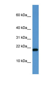 SH2D1A / SAP Antibody - SH2D1A / SAP antibody Western blot of Jurkat lysate.  This image was taken for the unconjugated form of this product. Other forms have not been tested.