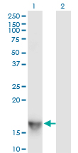 SH2D1A / SAP Antibody - Western Blot analysis of SH2D1A expression in transfected 293T cell line by SH2D1A monoclonal antibody (M01), clone 1C9.Lane 1: SH2D1A transfected lysate(14.2 KDa).Lane 2: Non-transfected lysate.