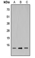 SH2D1A / SAP Antibody - Western blot analysis of SH2D1A expression in HEK293T (A); Raw264.7 (B); PC12 (C) whole cell lysates.