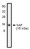 SH2D1A / SAP Antibody - Western blot of SAP antibody on NK-92 cell lysate at 10 ug/ml).