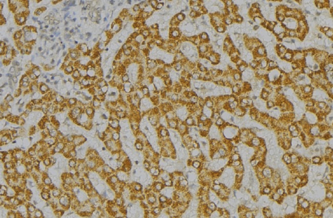 SH2D1A / SAP Antibody - 1:100 staining mouse liver tissue by IHC-P. The sample was formaldehyde fixed and a heat mediated antigen retrieval step in citrate buffer was performed. The sample was then blocked and incubated with the antibody for 1.5 hours at 22°C. An HRP conjugated goat anti-rabbit antibody was used as the secondary.