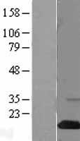 SH2D1A / SAP Protein - Western validation with an anti-DDK antibody * L: Control HEK293 lysate R: Over-expression lysate