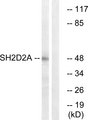 SH2D2A Antibody - Western blot analysis of lysates from HepG2 cells, using SH2D2A Antibody. The lane on the right is blocked with the synthesized peptide.