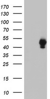 SH2D2A Antibody - HEK293T cells were transfected with the pCMV6-ENTRY control (Left lane) or pCMV6-ENTRY SH2D2A (Right lane) cDNA for 48 hrs and lysed. Equivalent amounts of cell lysates (5 ug per lane) were separated by SDS-PAGE and immunoblotted with anti-SH2D2A.