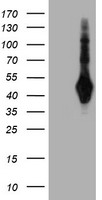SH2D2A Antibody - HEK293T cells were transfected with the pCMV6-ENTRY control (Left lane) or pCMV6-ENTRY SH2D2A (Right lane) cDNA for 48 hrs and lysed. Equivalent amounts of cell lysates (5 ug per lane) were separated by SDS-PAGE and immunoblotted with anti-SH2D2A.
