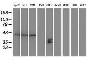 SH2D2A Antibody - Western blot of extracts (35 ug) from 9 different cell lines by using anti-SH2D2A monoclonal antibody.
