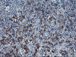 SH2D2A Antibody - IHC of paraffin-embedded Human tonsil using anti-SH2D2A mouse monoclonal antibody.