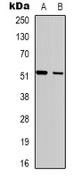 SH2D2A Antibody - Western blot analysis of SH2D2A expression in MDAMB435 (A); HepG2 (B) whole cell lysates.