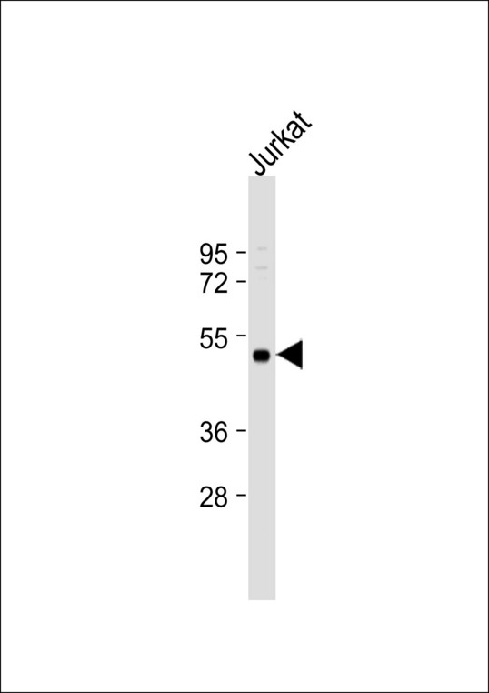 SH2D2A Antibody - Anti-SH2D2A Antibody at 1:1000 dilution + Jurkat whole cell lysate Lysates/proteins at 20 ug per lane. Secondary Goat Anti-Rabbit IgG, (H+L), Peroxidase conjugated at 1:10000 dilution. Predicted band size: 43 kDa. Blocking/Dilution buffer: 5% NFDM/TBST.
