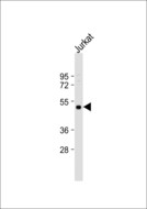 SH2D2A Antibody - Anti-SH2D2A Antibody at 1:1000 dilution + Jurkat whole cell lysate Lysates/proteins at 20 ug per lane. Secondary Goat Anti-Rabbit IgG, (H+L), Peroxidase conjugated at 1:10000 dilution. Predicted band size: 43 kDa. Blocking/Dilution buffer: 5% NFDM/TBST.