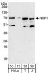 SH2D3A / NSP1 Antibody - Detection of Human NSP1 by Western Blot. Samples: Whole cell lysate from HeLa (15 and 15 ug), 293T (T; 50 ug) and Jurkat (J; 50 ug) cells. Antibodies: Affinity purified rabbit anti-NSP1 antibody used for WB at 0.04 ug/ml. Detection: Chemiluminescence with an exposure time of 3 minutes.