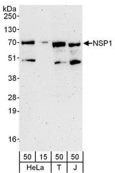 SH2D3A / NSP1 Antibody - Detection of Human NSP1 by Western Blot. Samples: Whole cell lysate from HeLa (15 and 15 ug), 293T (T; 50 ug) and Jurkat (J; 50 ug) cells. Antibodies: Affinity purified rabbit anti-NSP1 antibody used for WB at 0.04 ug/ml. Detection: Chemiluminescence with an exposure time of 3 minutes.