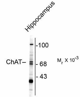 SH2D3C / NSP3 Antibody - Western Blot of CHAT antibody. Western blot of rat brain lysate showing specific immunolabeling of ~68/70k ChAT