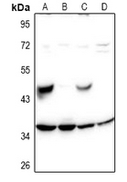 SH2D5 Antibody - Western blot analysis of SH2D5 expression in Hela (A), A549 (B), PC12 (C), AML12 (D) whole cell lysates.