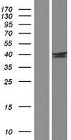 SH2D5 Protein - Western validation with an anti-DDK antibody * L: Control HEK293 lysate R: Over-expression lysate