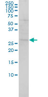 SH3BGR Antibody - SH3BGR monoclonal antibody (M01), clone 3B7 Western blot of SH3BGR expression in HeLa.