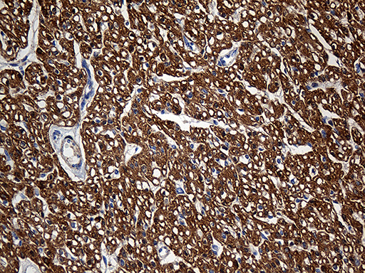 SH3BGR Antibody - Immunohistochemical staining of paraffin-embedded Human adult heart tissue within the normal limits using anti-SH3BGR mouse monoclonal antibody. (Heat-induced epitope retrieval by 1mM EDTA in 10mM Tris buffer. (pH8.5) at 120 oC for 3 min. (1:500)