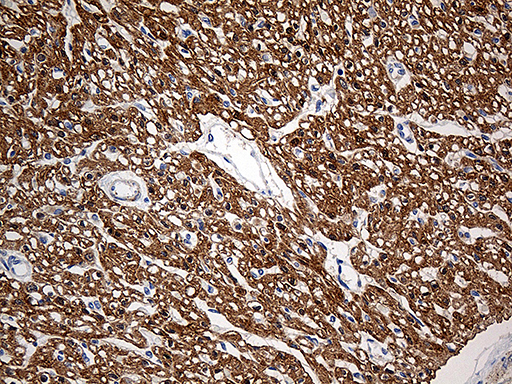 SH3BGR Antibody - Immunohistochemical staining of paraffin-embedded Human adult heart tissue within the normal limits using anti-SH3BGR mouse monoclonal antibody. (Heat-induced epitope retrieval by 1mM EDTA in 10mM Tris buffer. (pH8.5) at 120 oC for 3 min. (1:500)