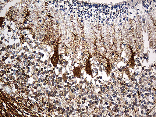 SH3BGR Antibody - Immunohistochemical staining of paraffin-embedded Human embryonic cerebellum within the normal limits using anti-SH3BGR mouse monoclonal antibody. (Heat-induced epitope retrieval by 1mM EDTA in 10mM Tris buffer. (pH8.5) at 120 oC for 3 min. (1:500)
