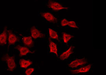 SH3BGR Antibody - Staining HeLa cells by IF/ICC. The samples were fixed with PFA and permeabilized in 0.1% Triton X-100, then blocked in 10% serum for 45 min at 25°C. The primary antibody was diluted at 1:200 and incubated with the sample for 1 hour at 37°C. An Alexa Fluor 594 conjugated goat anti-rabbit IgG (H+L) Ab, diluted at 1/600, was used as the secondary antibody.
