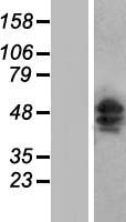 SH3BGR Protein - Western validation with an anti-DDK antibody * L: Control HEK293 lysate R: Over-expression lysate