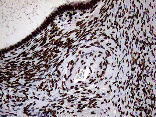 SH3BGRL Antibody - Immunohistochemical staining of paraffin-embedded Human Ovary tissue within the normal limits using anti-SH3BGRL mouse monoclonal antibody. (Heat-induced epitope retrieval by 1mM EDTA in 10mM Tris buffer. (pH8.5) at 120°C for 3 min. (1:150)