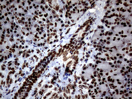 SH3BGRL Antibody - Immunohistochemical staining of paraffin-embedded Human pancreas tissue within the normal limits using anti-SH3BGRL mouse monoclonal antibody. (Heat-induced epitope retrieval by 1mM EDTA in 10mM Tris buffer. (pH8.5) at 120°C for 3 min. (1:150)