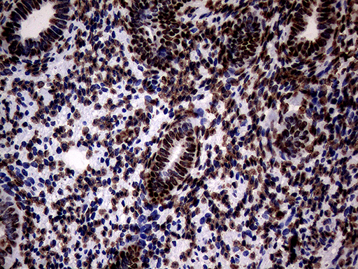 SH3BGRL Antibody - Immunohistochemical staining of paraffin-embedded Human endometrium tissue within the normal limits using anti-SH3BGRL mouse monoclonal antibody. (Heat-induced epitope retrieval by 1mM EDTA in 10mM Tris buffer. (pH8.5) at 120°C for 3 min. (1:150)