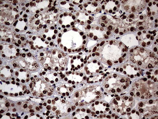 SH3BGRL Antibody - Immunohistochemical staining of paraffin-embedded Human Kidney tissue within the normal limits using anti-SH3BGRL mouse monoclonal antibody. (Heat-induced epitope retrieval by 1mM EDTA in 10mM Tris buffer. (pH8.5) at 120°C for 3 min. (1:150)