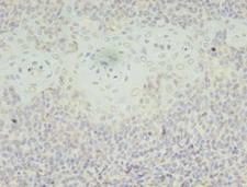 SH3BGRL Antibody - Immunohistochemistry of paraffin-embedded human tonsil tissue using antibody at dilution of 1:100.