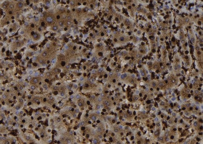 SH3BGRL Antibody - 1:100 staining human liver tissue by IHC-P. The sample was formaldehyde fixed and a heat mediated antigen retrieval step in citrate buffer was performed. The sample was then blocked and incubated with the antibody for 1.5 hours at 22°C. An HRP conjugated goat anti-rabbit antibody was used as the secondary.