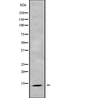 SH3BGRL2 Antibody - Western blot analysis SH3BGRL2 using HepG2 whole cells lysates