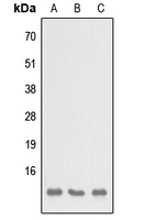 SH3BGRL3 Antibody - Western blot analysis of SH3BGRL3 expression in HEK293T (A); NS-1 (B); H9C2 (C) whole cell lysates.