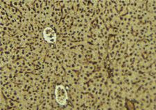 SH3BGRL3 Antibody - 1:100 staining mouse liver tissue by IHC-P. The sample was formaldehyde fixed and a heat mediated antigen retrieval step in citrate buffer was performed. The sample was then blocked and incubated with the antibody for 1.5 hours at 22°C. An HRP conjugated goat anti-rabbit antibody was used as the secondary.