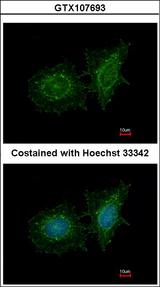 SH3BP1 Antibody - Immunofluorescence of methanol-fixed HeLa using SH3BP1 antibody at 1:200 dilution.