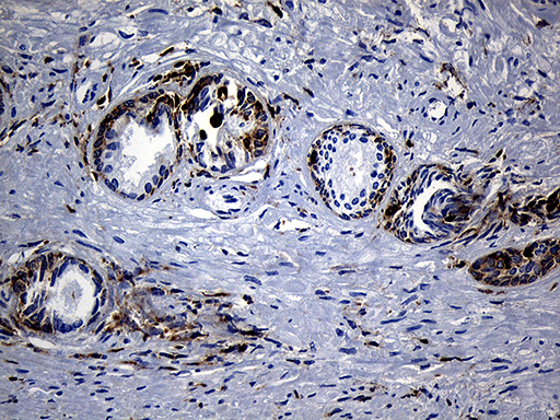 SH3BP1 Antibody - Immunohistochemical staining of paraffin-embedded Human prostate tissue within the normal limits using anti-SH3BP1 mouse monoclonal antibody. (Heat-induced epitope retrieval by 1mM EDTA in 10mM Tris buffer. (pH8.5) at 120°C for 3 min. (1:500)